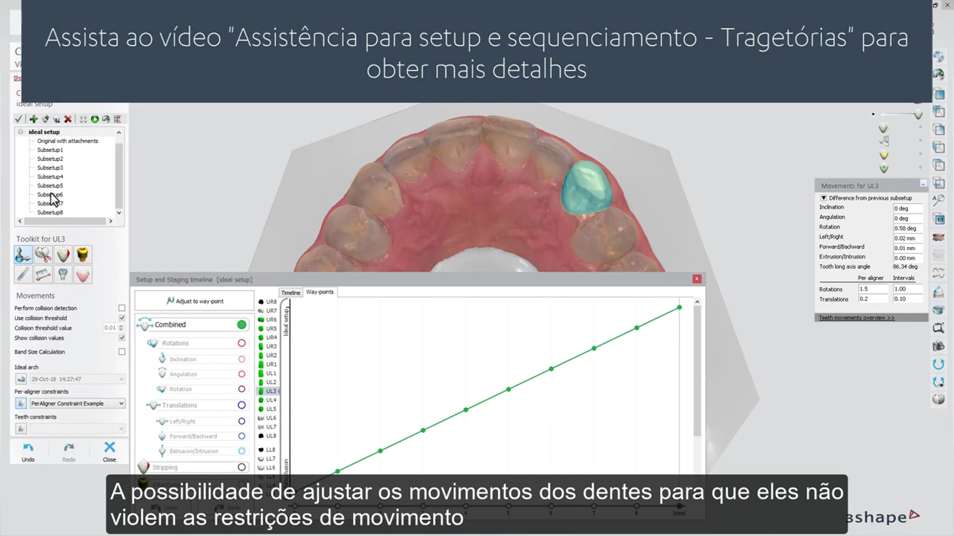 3Shape Clear Aligner Studio – Per-aligner Movement Constraints BR PT –  Integrated Dentistry & Orthodontics