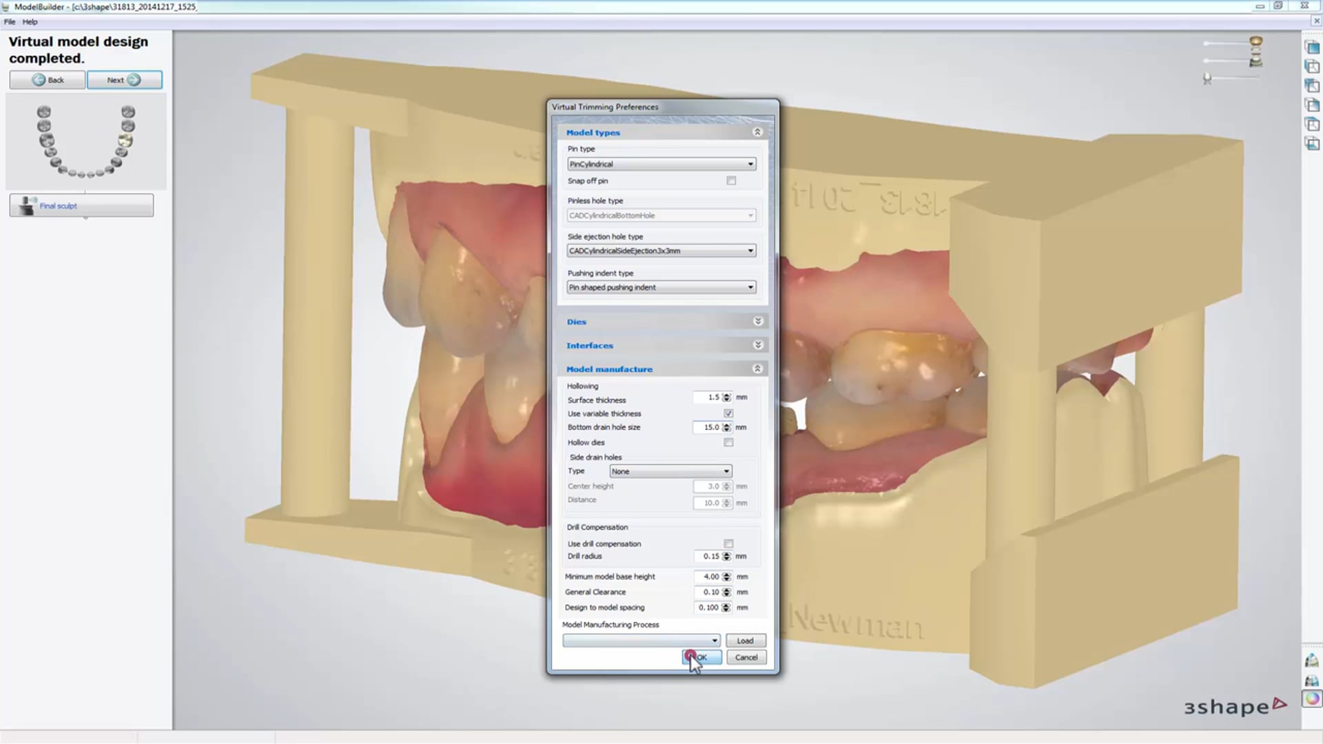 3Shape Dental System – Digital Model Design – Integrated Dentistry ...