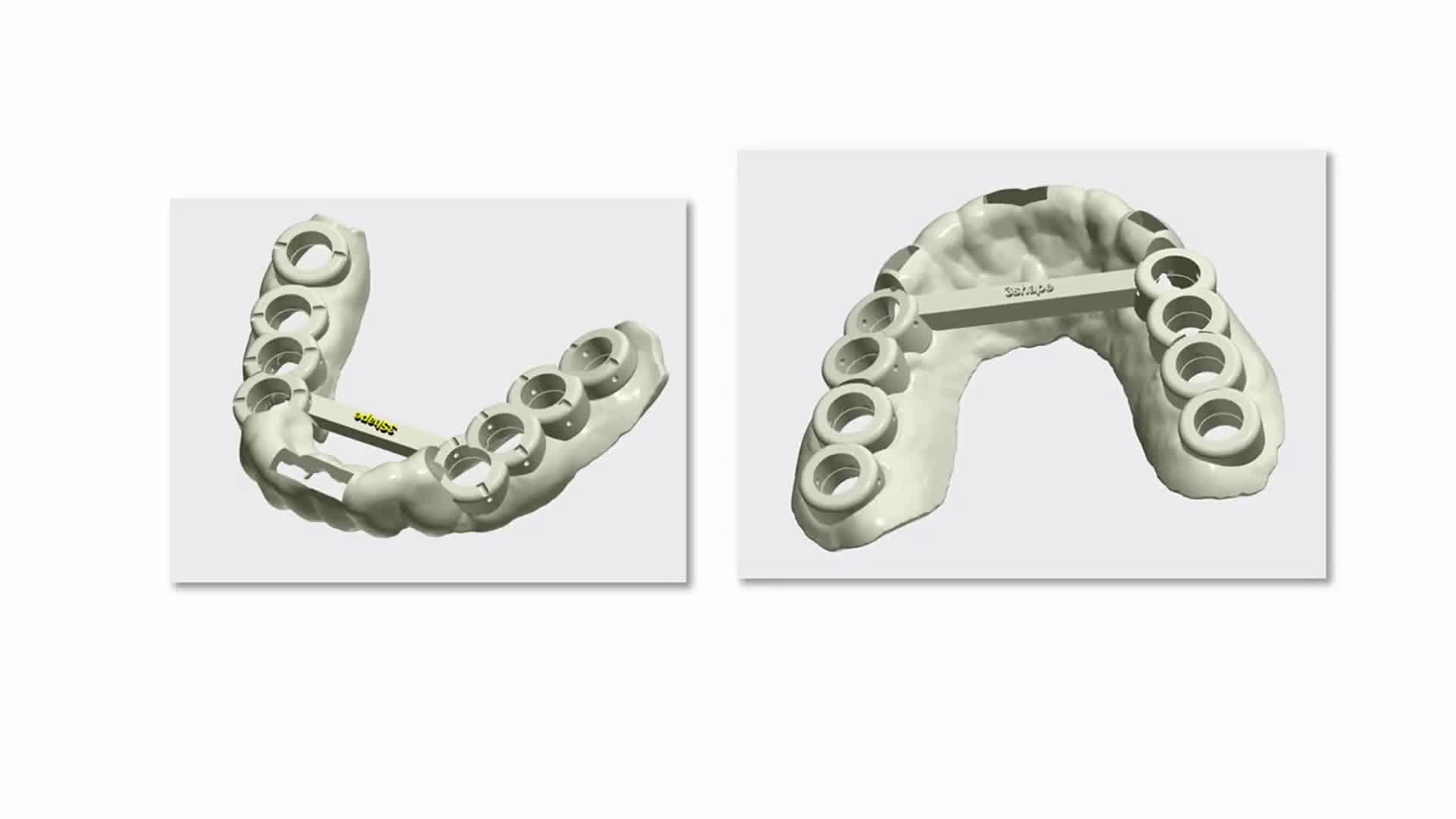 3Shape TRIOS Scanning for surgical guide – Dual Sided Free End Case ...