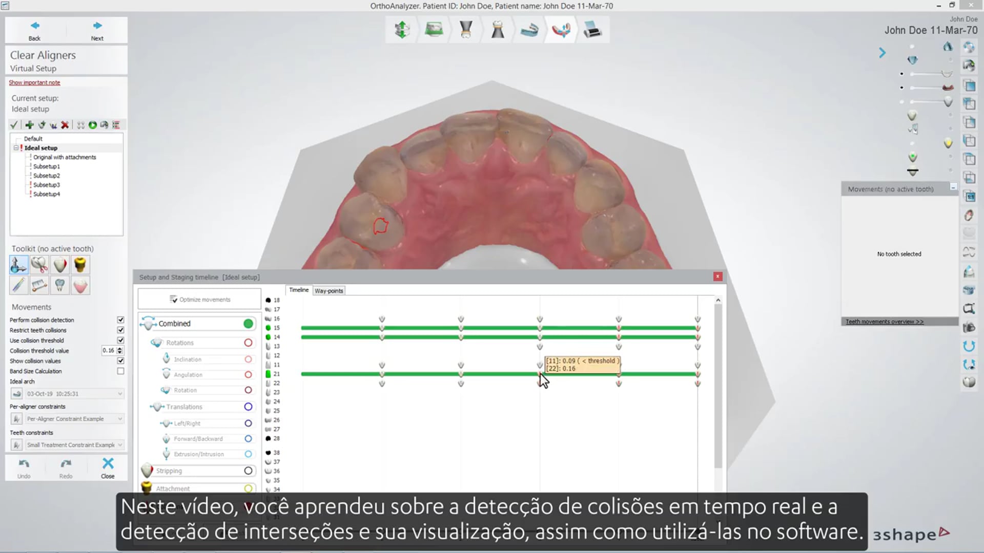 3Shape Clear Aligner Studio – Intersection Visualization and Collision  Detection BR PT – Integrated Dentistry & Orthodontics